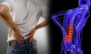 The causes of the development of lumbar osteochondrosis