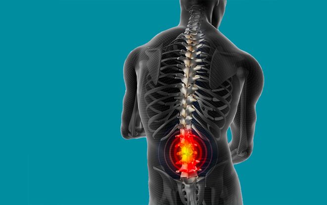 back pain in the lumbar region