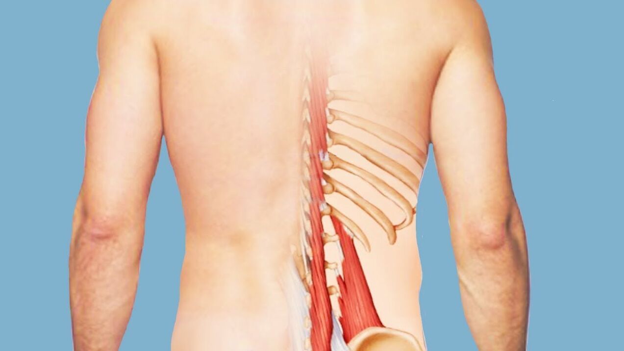 myositis as a cause of back pain